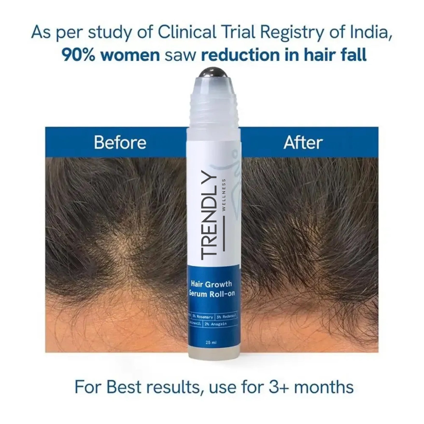 Trenldy Hair Growth Oil